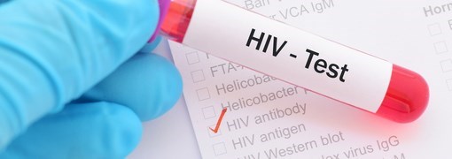  בדיקת HIV - תמונה